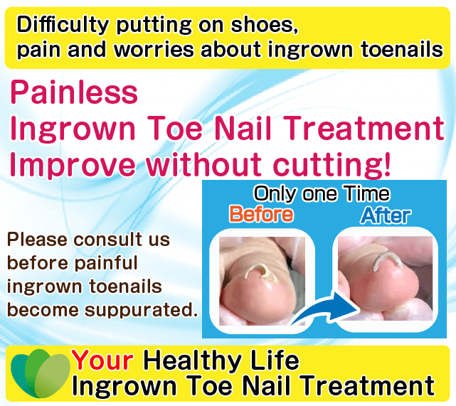 Ingrown Toe Nails
