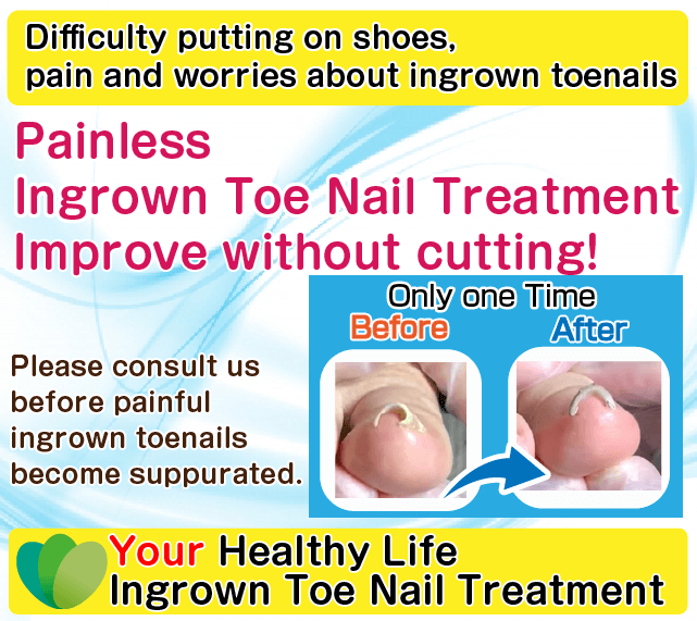 Ingrown Toenail Treatments